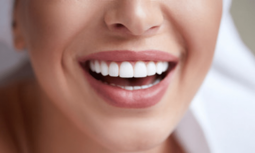teeth whitening precautions