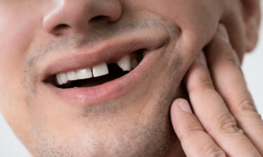 tips to handle tooth injury