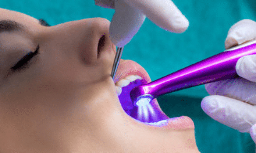 know about dental sealants
