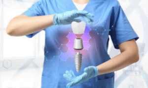 Dental implants process