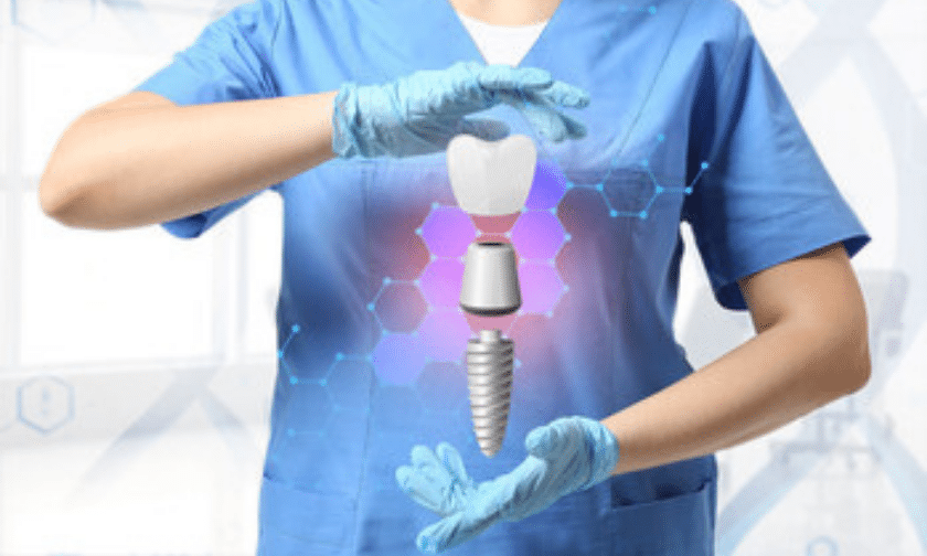 Dental implants process