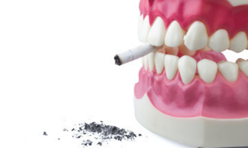 bad dental habits