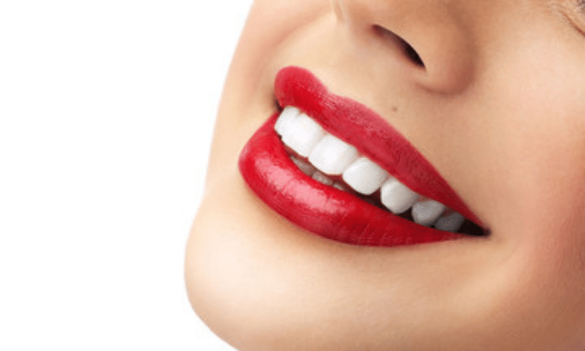teeth whitening