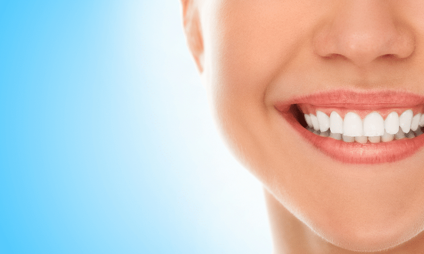Teeth Whitening