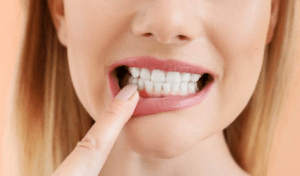 Woman pointing to her white teeth while smiling, demonstrating dental health and hygiene results.