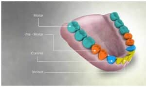 root canal treatment