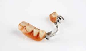 Dentures Orem