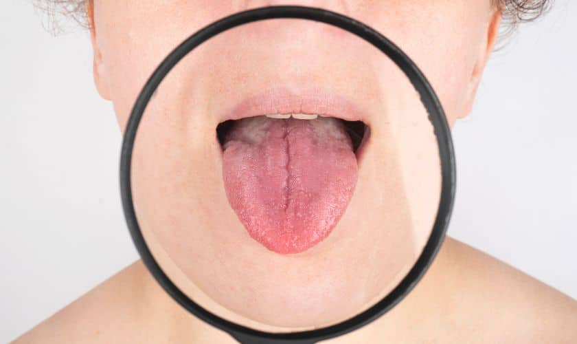 Oral Cancer Prevention Tips
