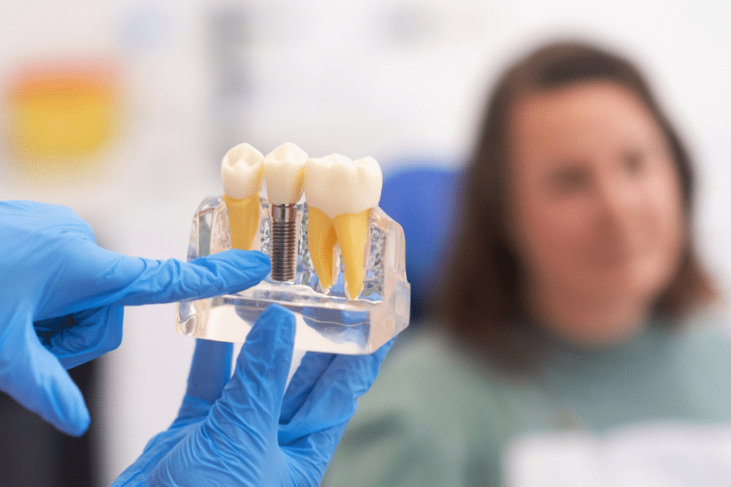 How Dental Implants in Orem can Transform Your Facial Aesthetics