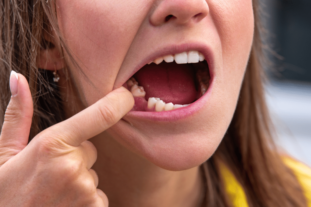 Lost a Tooth? Here’s How an Emergency Dentist Can Rescue Your Smile