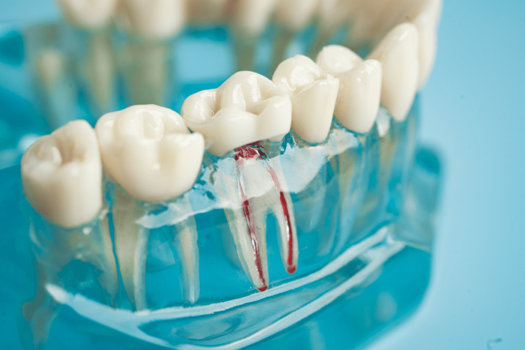 Is Root Canal Therapy in Orem Really as Scary as You Think