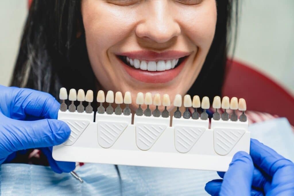 Dental Veneers in Orem