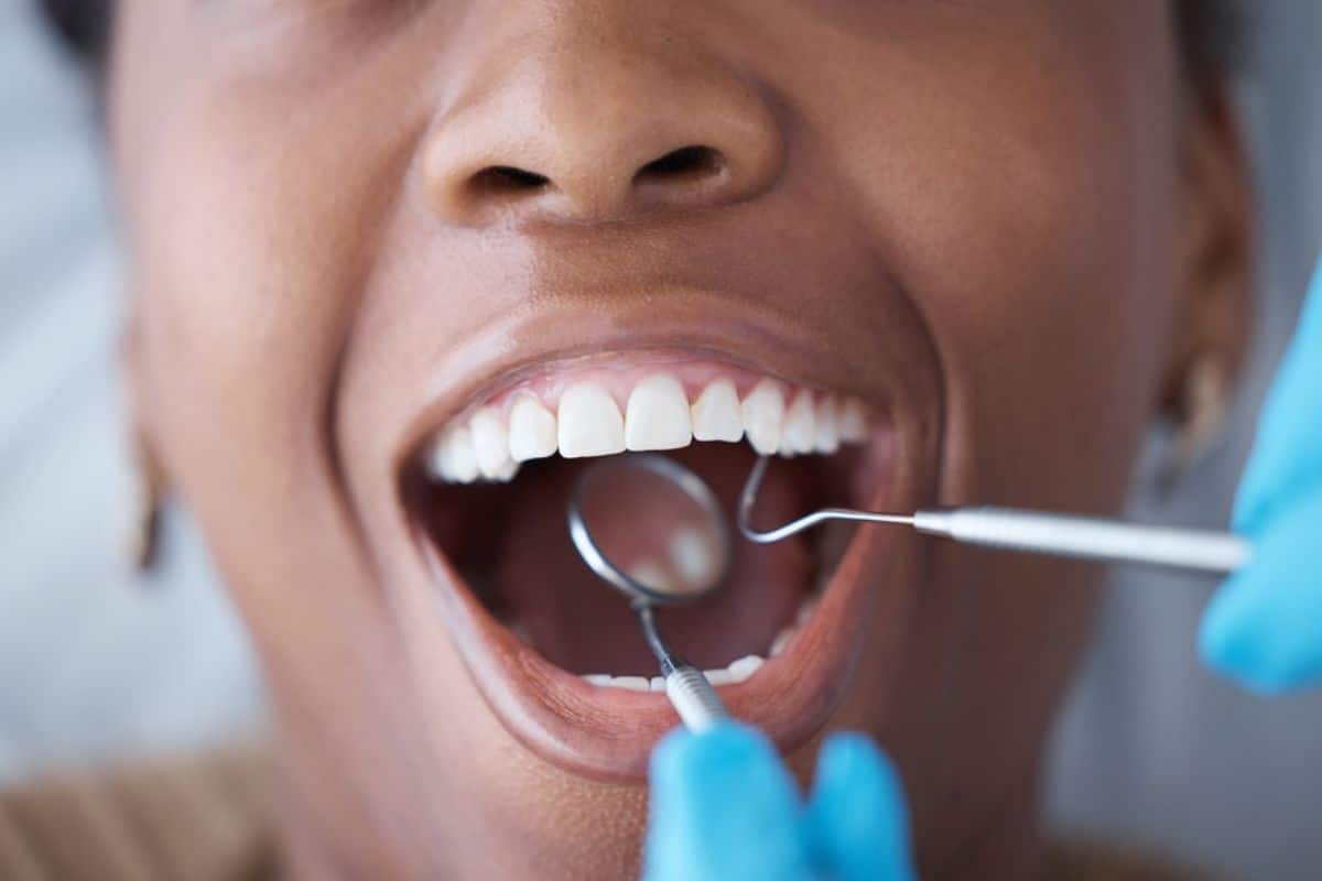 Connection Between Oral Health and Gut Health | The Dental Center