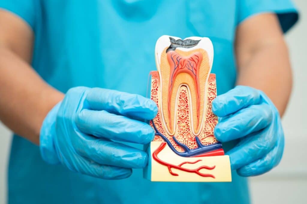 Root Canal Therapy in Orem