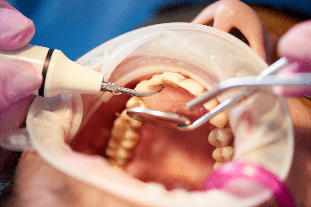 family dentistry in Orem