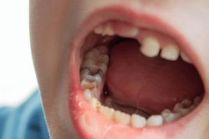 dentist in Orem