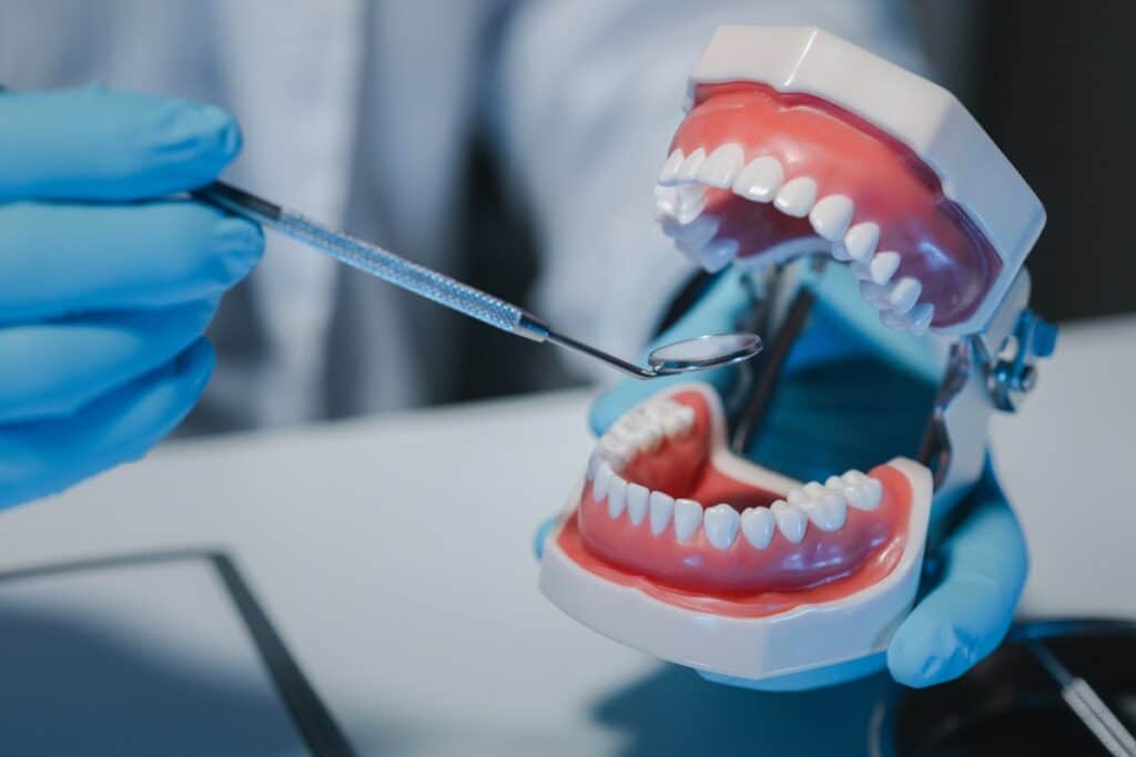 Dental model showing tools used during a root canal treatment procedure